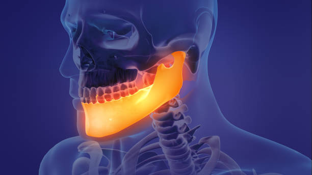 Animation of a painful mandible