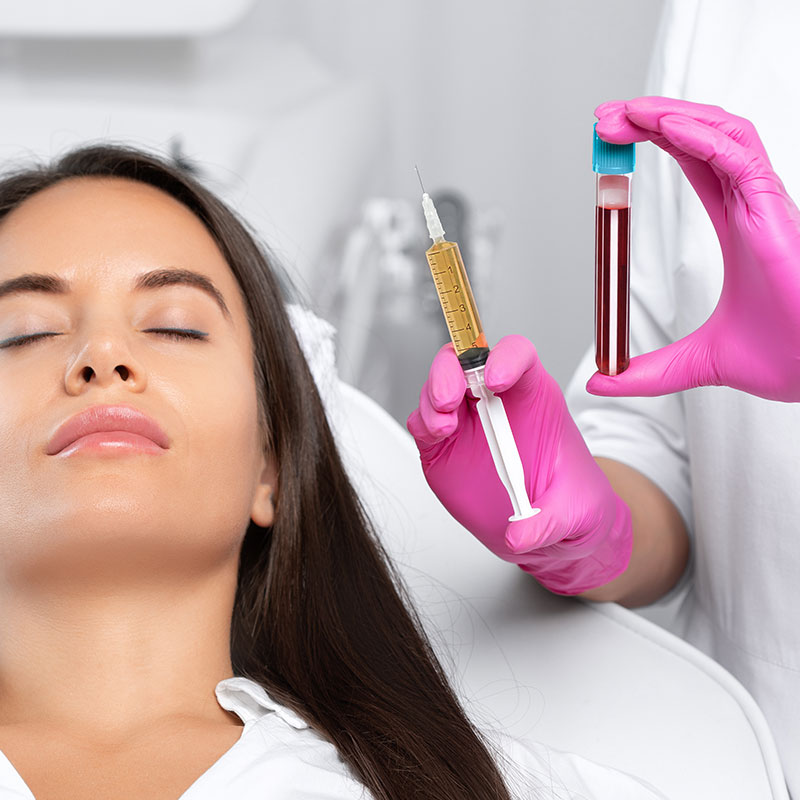 Platelet Rich Fibrin (PRF)